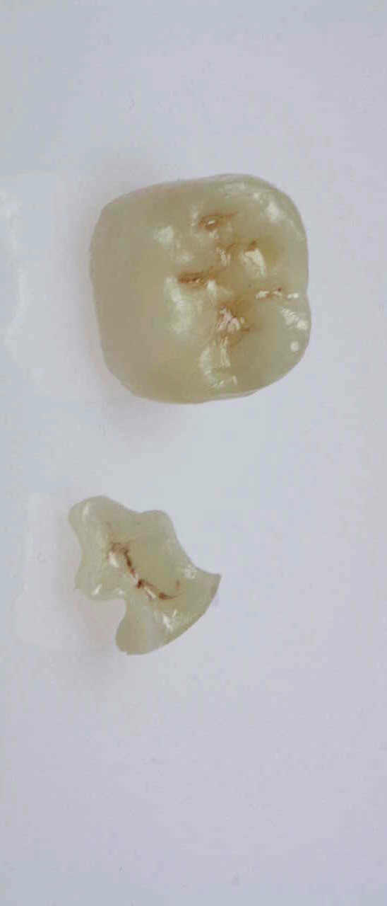 cerec
