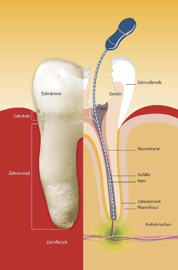 Endo2