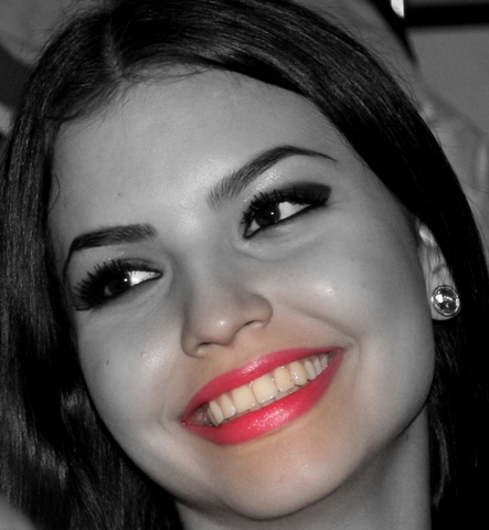 Laecheln Cerec