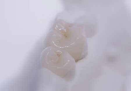 cerec26