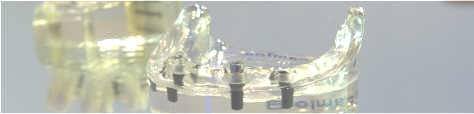 implantat