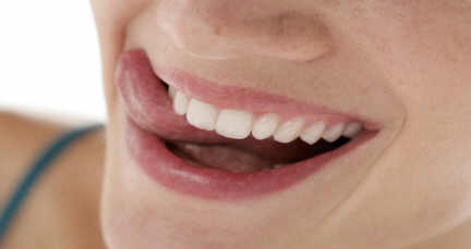 veneer